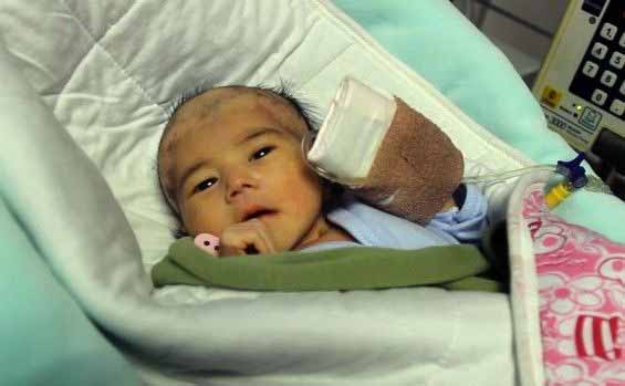 900,000 Chinese babies born with birth defects annually - China Plus