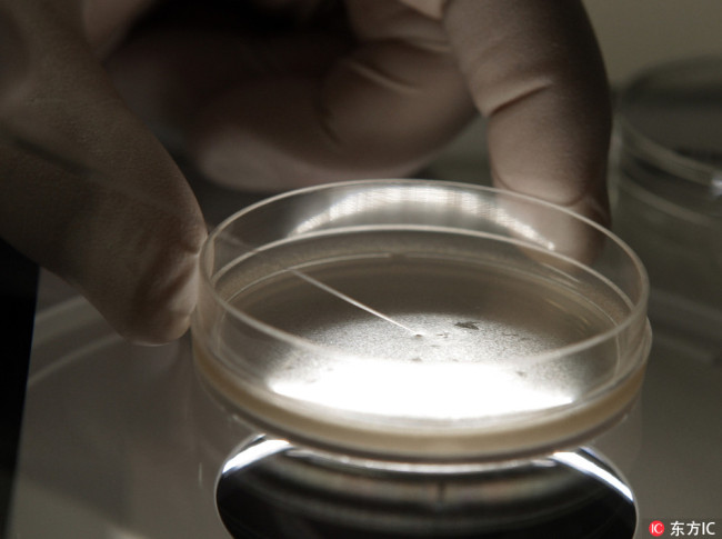 A research specialist examines human embryonic stem cells under a microscope. [File Photo: IC]