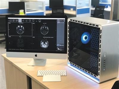BioMind TM, a Chinese-developed AI system designed to assist doctors in CT, MRI neural image diagnosis. [Photo: Beijing Tiantan Hospital]