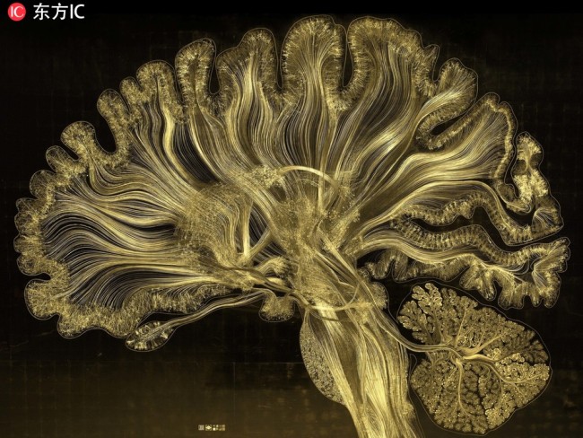  The images showcase the incredible complexity of the human brain through an explosive fusion of art and science. [Photo: IC]