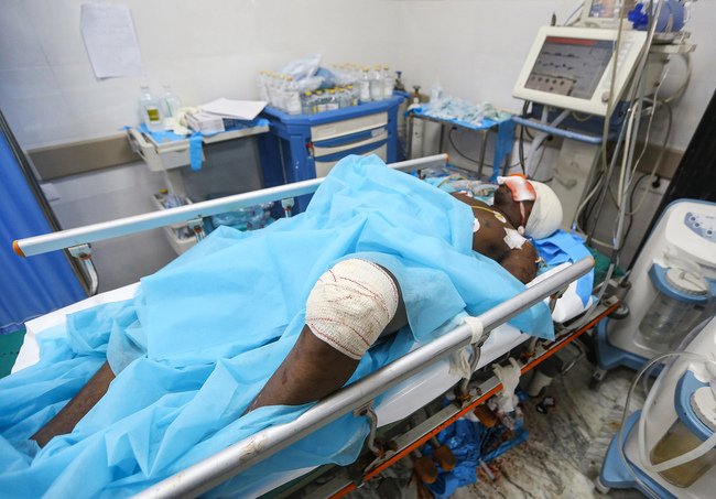 An injured migrant lies on a hospital bed connected to life support systems at a medical emergency ward in a hospital in the capital Tripoli on July 3, 2019, following an air strike on a nearby building that left dozens killed. [Photo: VCG/AFP/Mahmud Turkia]