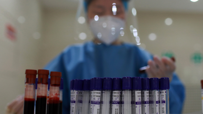 Na snímku odebírá lékařka vzorek krve od dobrovolníků, kteří byli naočkováni inaktivovanou vakcínou. Fotografie: VCG