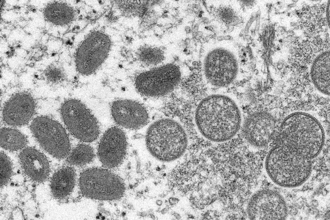 Figura e virusit të lijës së majmunit në mikroskop/ VCG