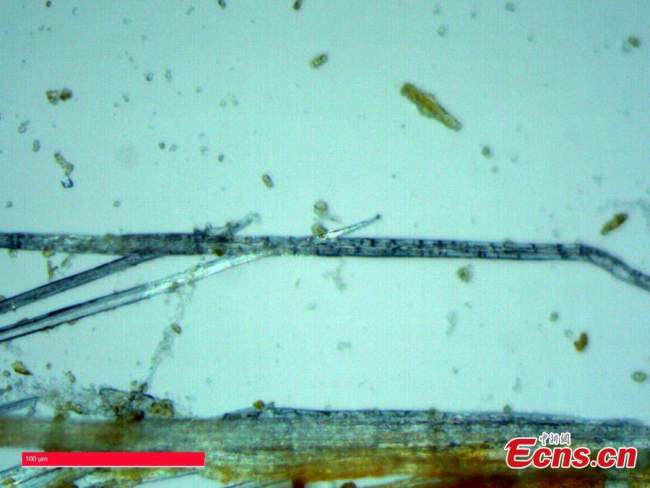 Η φωτογραφία αρχείου δείχνει προϊόντα ύφανσης μπαμπού που φαίνονται στο μικροσκόπιο. (Η φωτογραφία παρέχεται στην υπηρεσία China News Service)